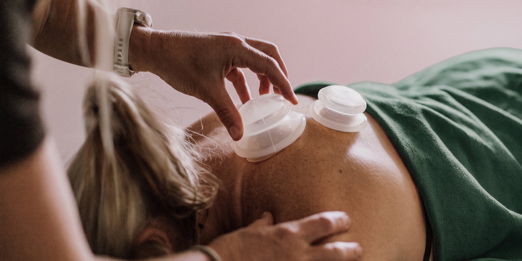 Dry Needling & Cupping